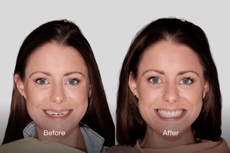 Two portrait photographs arranged side by side.
