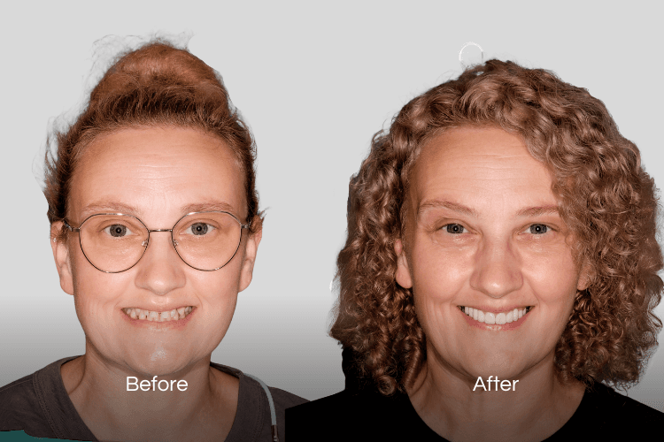 Two portrait photographs arranged side by side.