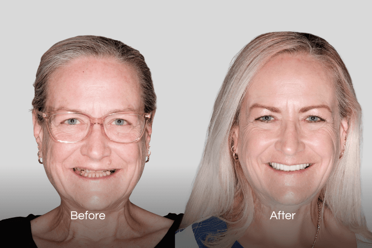 Two portrait photographs arranged side by side.