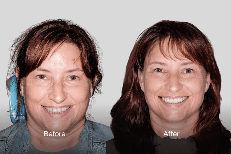 Two portrait photographs arranged side by side.