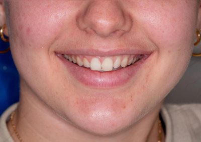 Orthodontics After