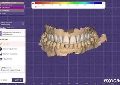 Teeth Grinding