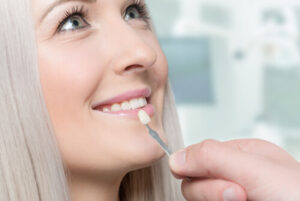 what are veneers application