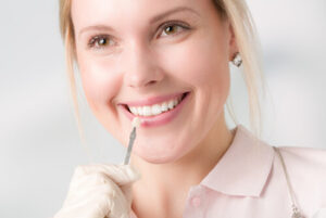 what are veneers consultation