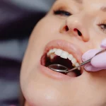 Oral Cancer